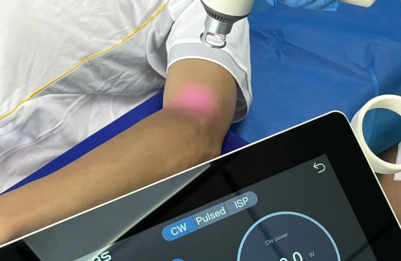 CURELAS-Laser Therapy